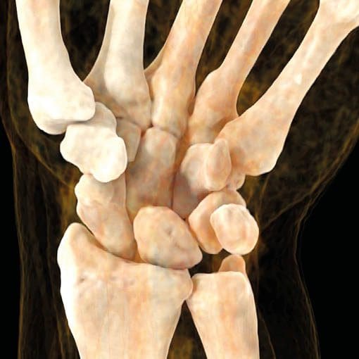 Dynamisches CT der Hand