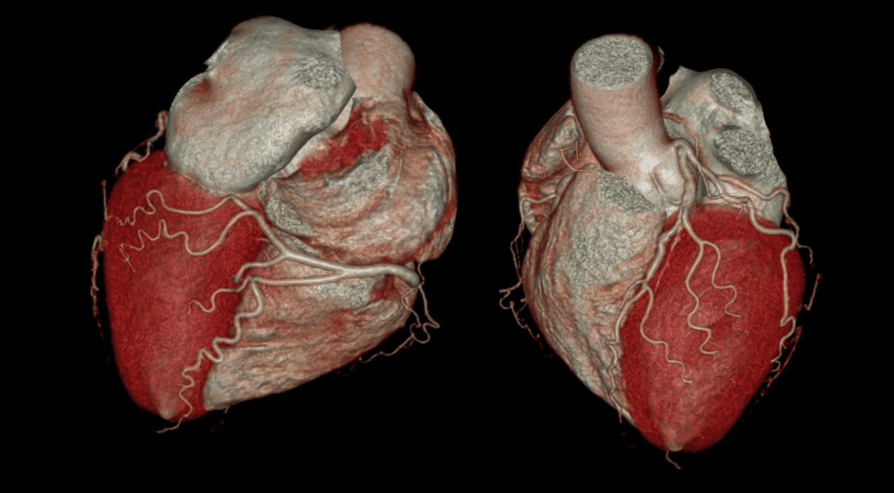 Cardio CT München